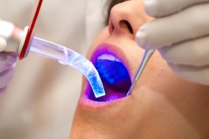 Laser Dentistry